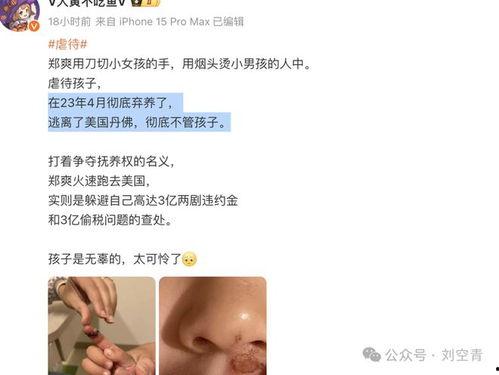 吃瓜爆料免费进网站,免费吃瓜爆料，畅游网站新体验！