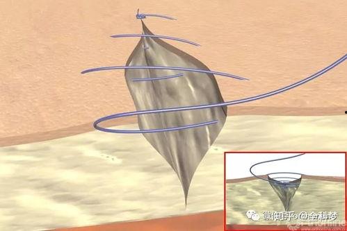 缝合视频教学,缝合技巧全解析